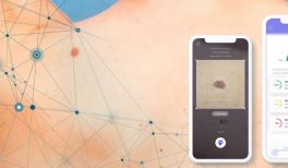 Analysis of Skinive algorithm’s accuracy for risk assessment of skin conditions, based on machine learning algorithms.