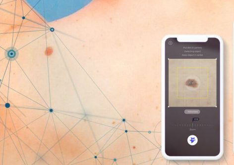 Анализ точности алгоритма Skinive для оценки риска заболеваний кожи, основанного на алгоритмах машинного обучения в 2020 году