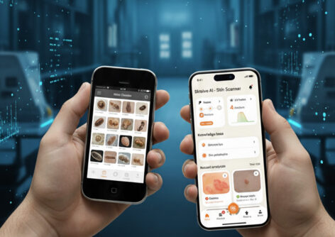 From Mole Checker to AI Skin Scanner: 5 Years of Innovation 🎉