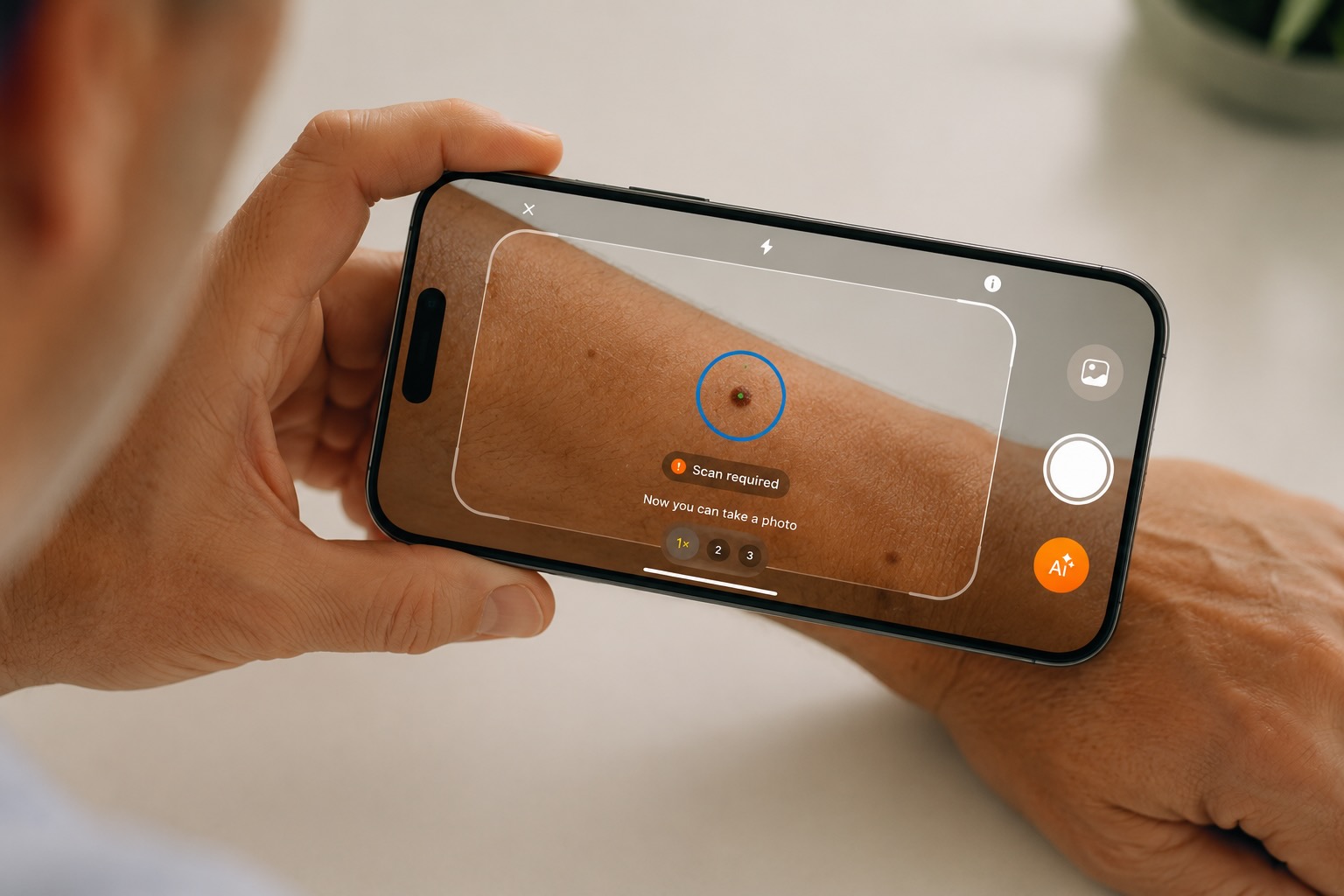 Free Mole checker & Scanner - Skinive AI app